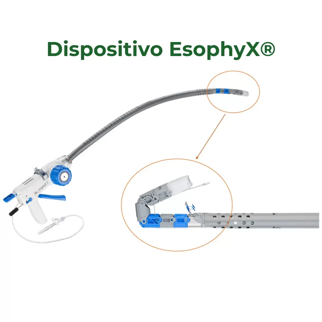 Dispositivo EsophyX